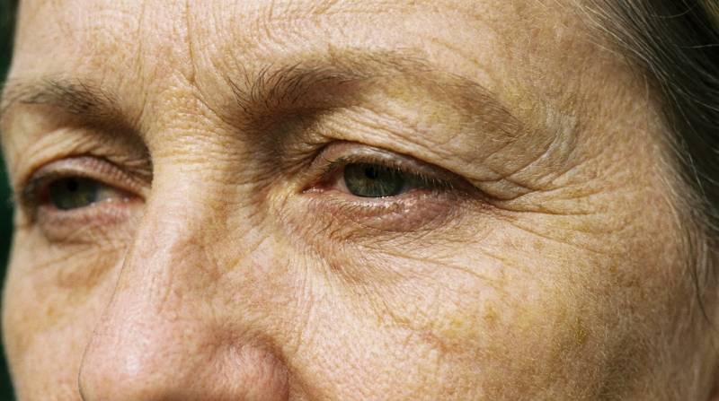 Arrêter le sucre effets peau | Les conseils d'Abc Laser